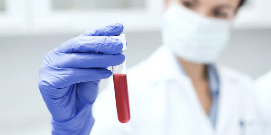 Doktor besieht sich Blutspende in Reagenzglas